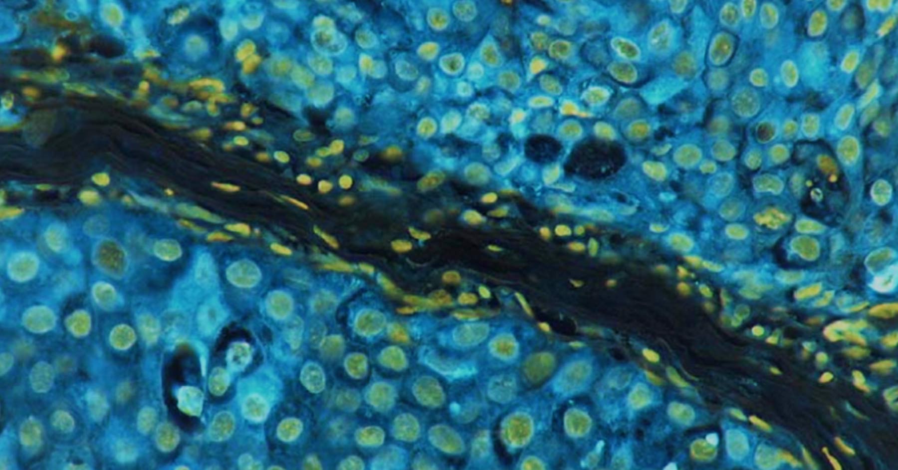 Build it yourself: How a small team deployed OpenStack